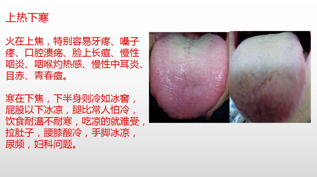 上热下寒口腔溃疡便秘手腿凉,容易上火口腔溃疡手脚冰凉