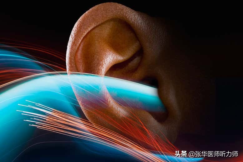 光学人工耳蜗预计2025进入临床试验