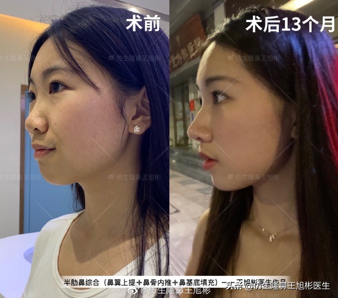 被鼻子封印的颜值,那些被鼻子封印的颜值