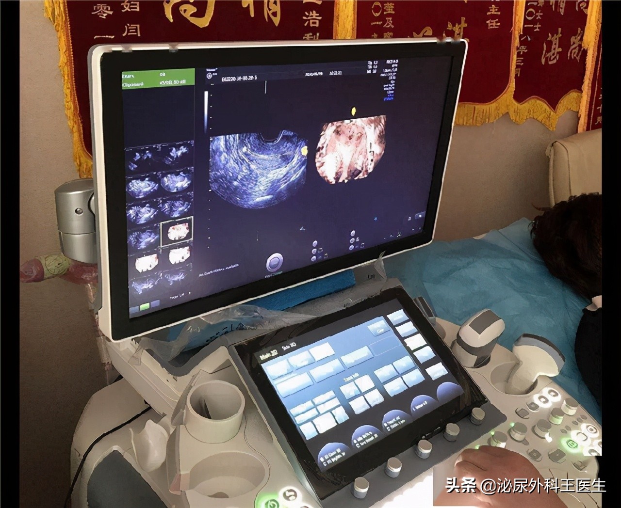 阴式b超检查前需要注意事项,什么是阴式b超检查