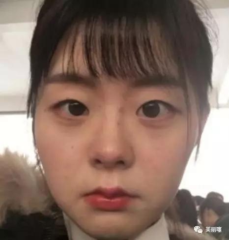 女生最丑的脸型梨形脸,女生脸型难看的表现