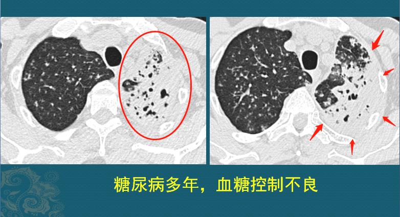 母亲节适合给母亲送的礼物推荐,母亲节送给母亲十佳礼物实用
