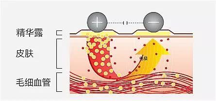 射频美容仪哪个牌子最好用,amiro射频美容仪测评