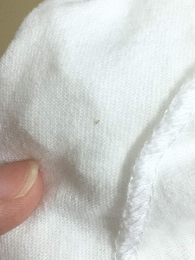 苹果醋对人体有哪些好处,喝苹果醋的好处和坏处可以减肥吗