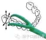 牙可以刷的干干净净的小秘诀,牙到底怎么刷才能刷得干净