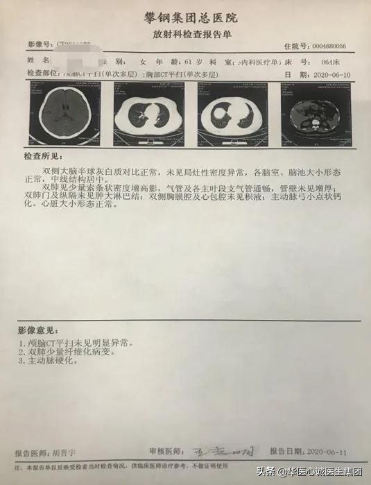 窦性心动过速查房,攀钢集团总医院心内科