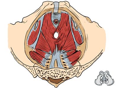 漏尿需要做盆底肌修复吗,盆底肌修复之后还是漏尿