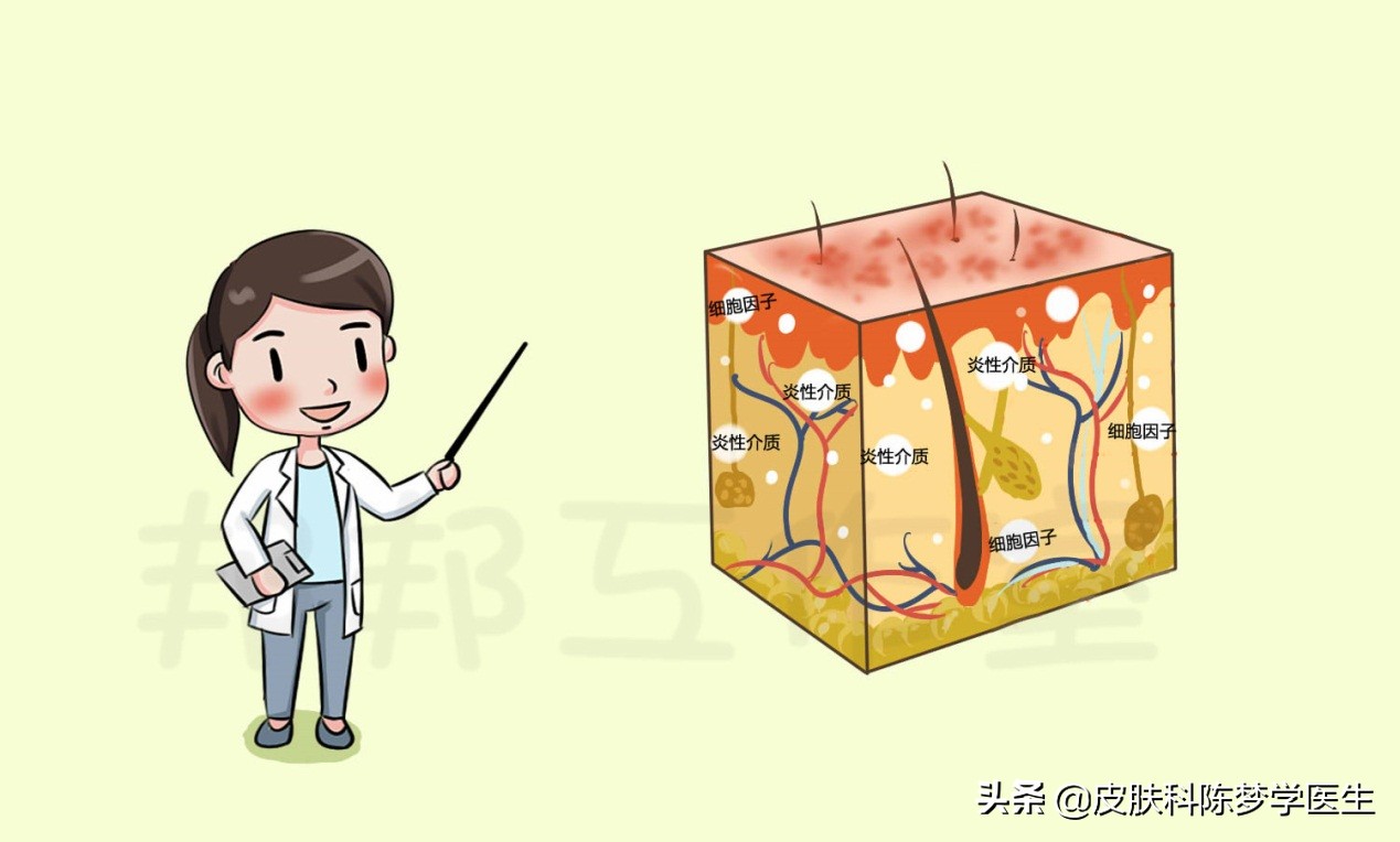 湿疹全身痒住院怎么检查治疗,湿疹红肿痒痒怎么治疗效果好