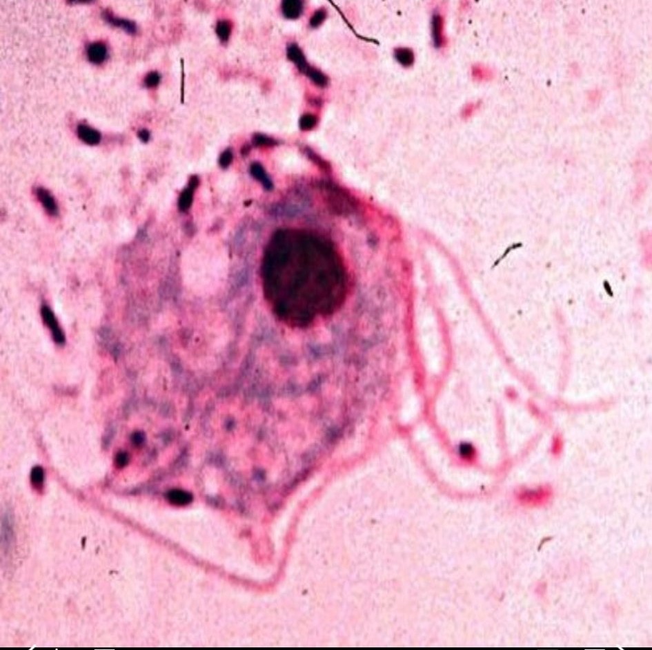 快速认识阴部瘙痒的原因和治疗用药，绝对的干货