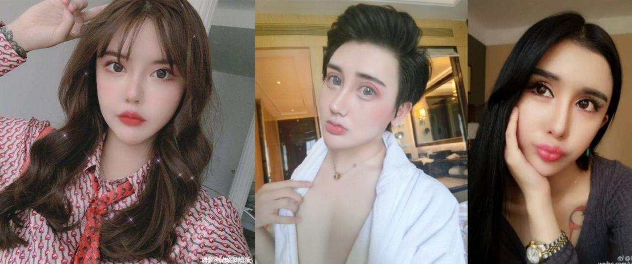 韩安冉整容失败案例,韩安冉整容教科书