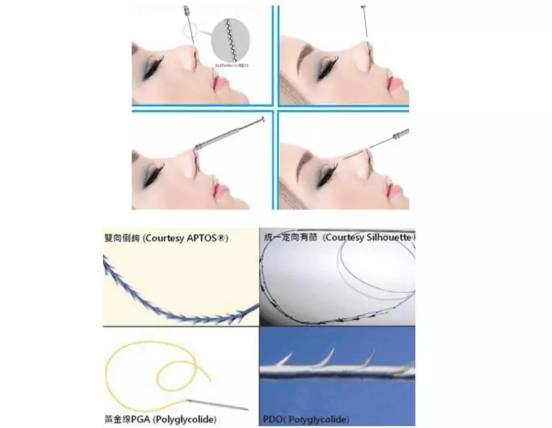 鼻子如何变漂亮,告诉你行业秘密