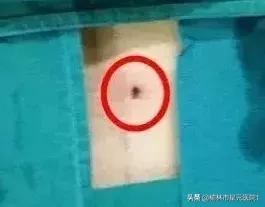 榆林市中医院治腰椎间盘突出症,榆林市治腰椎椎间盘突出