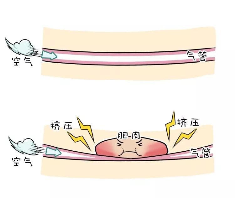 舍友打呼让他听啥歌,舍友打呼怎么解决