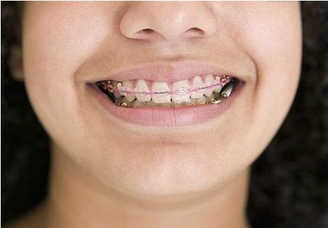 地包天科普主题,孩子地包天的治疗方法