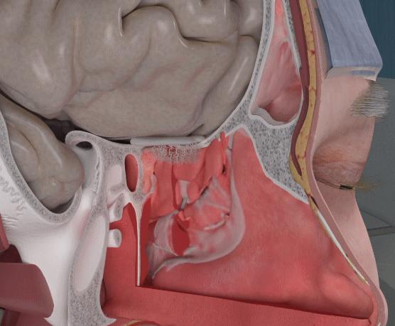 为什么我一吃辣的就会流鼻涕,为什么人一吃辣的就流鼻涕