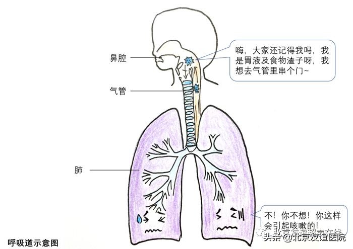 中医治疗胃食管反流病靠谱吗,胃食管反流病北京医院
