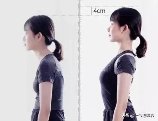 驼背怎么办最有效的方法,驼背怎么矫正最有效方法