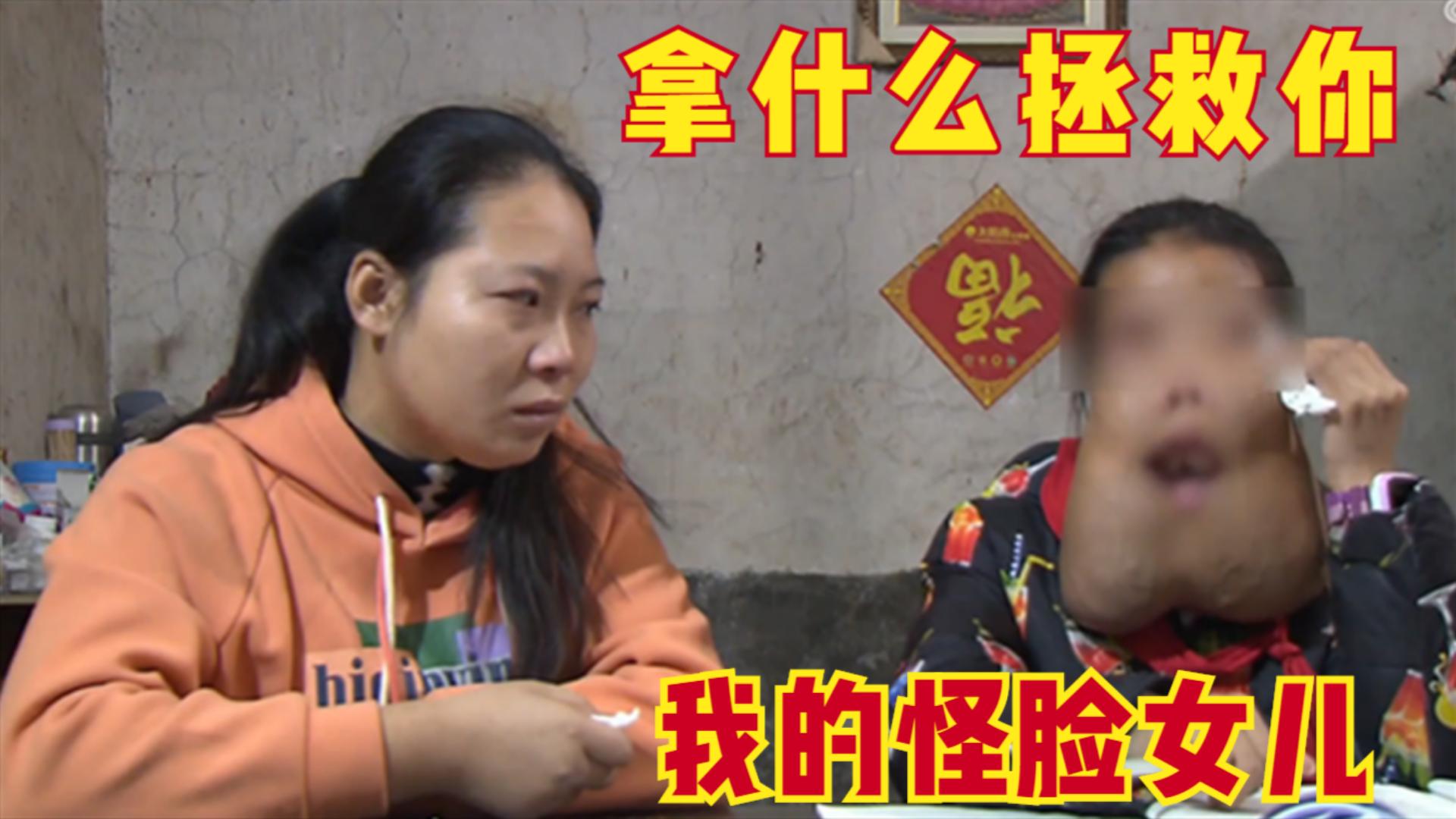 孩子13岁脸上大面积长痘,四岁儿童下巴长痘