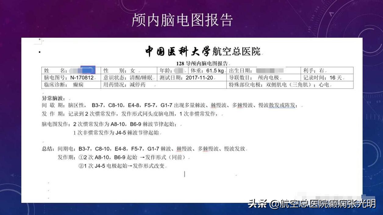 张光明左颞叶癫痫手术成功率,张光明谈治疗癫痫的方法有哪些