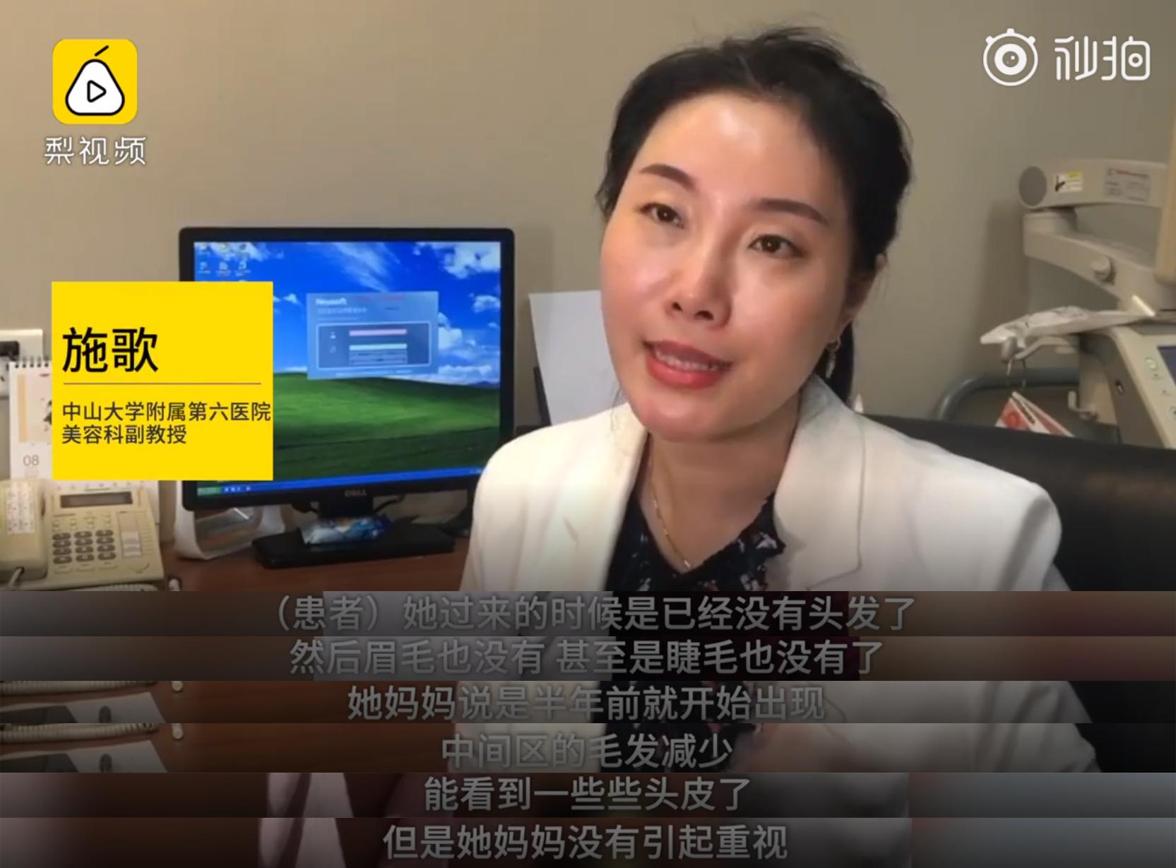 解救秃头少女防脱发的好方法,青少年脱发的原因和治疗方法