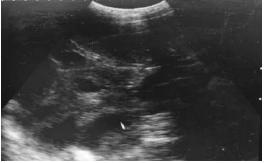 母猪兽用b超怎么看图谱,兽用b超机如何看母猪怀孕