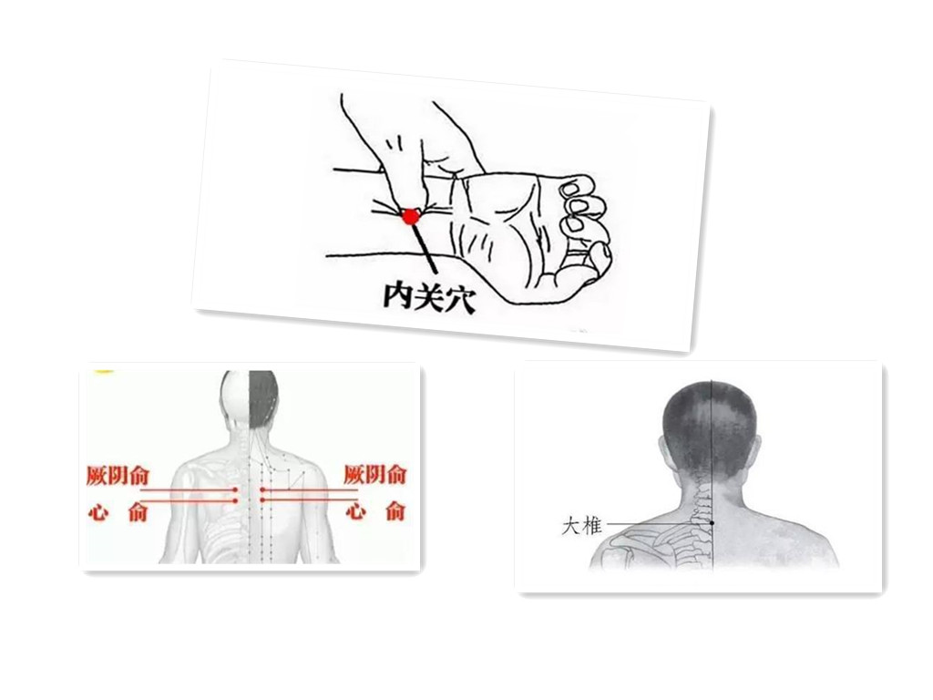 心律失常中医针灸能调好吗,针灸可以治疗心律失常吗