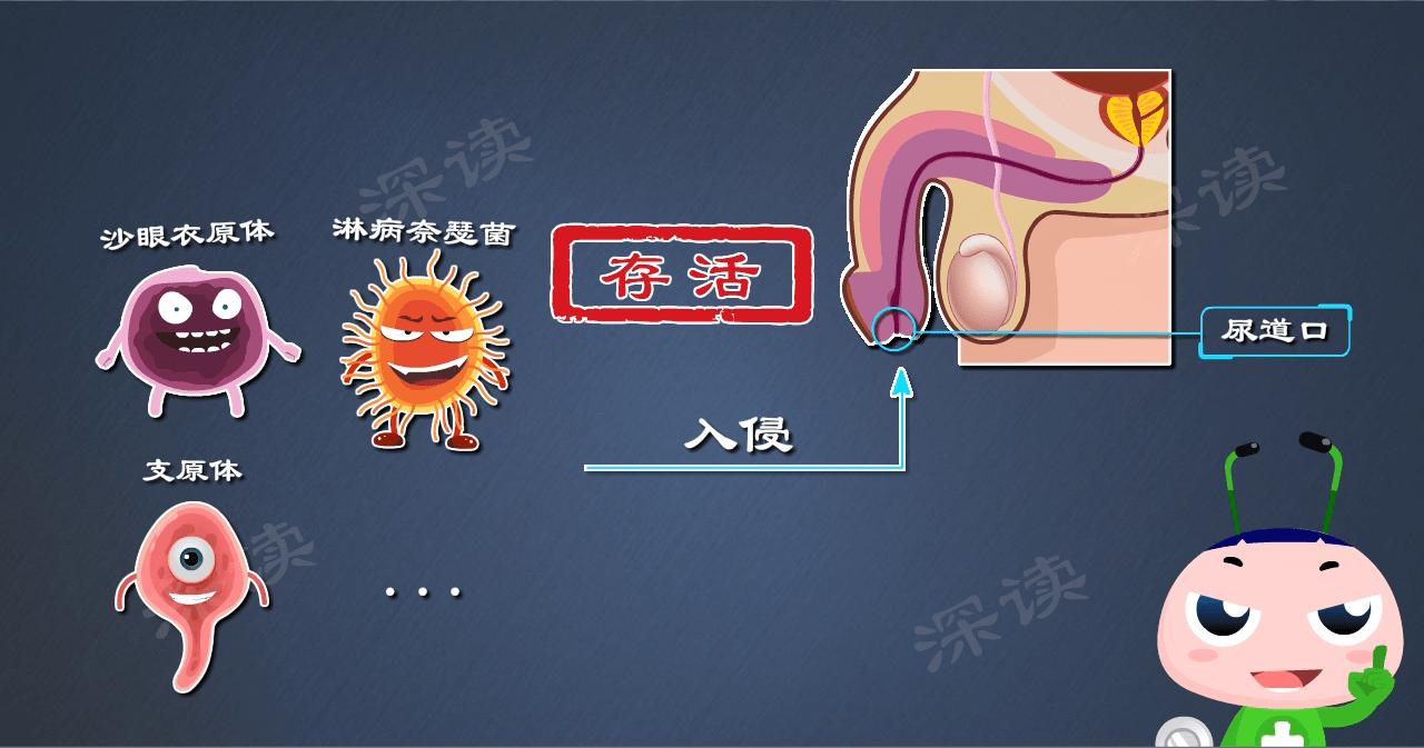 穿错内裤了怎么办,穿错内裤会得什么病