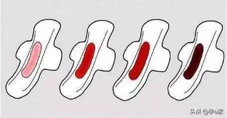 第一次姨妈色为啥是深咖色,姨妈色是什么色