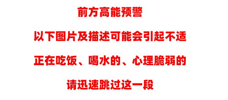 奥利司他排出油可以瘦吗,奥利司他可以排顽固脂肪吗