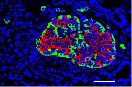 nature重磅揭秘人类抗击糖尿病历史,nature十大科学进展