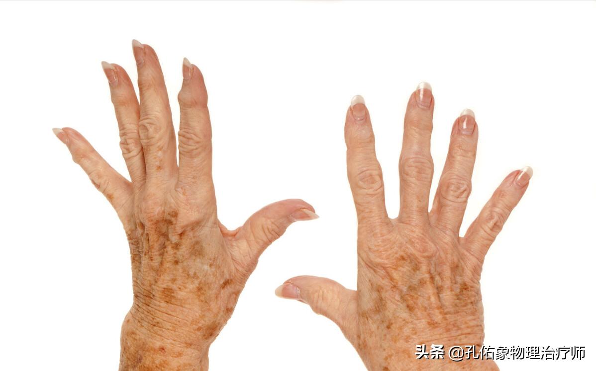 多年的老年斑消除最好的方法,为什么会长老年斑如何可以去除