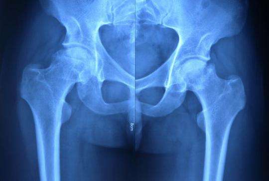 强直性脊柱炎生物制剂影响怀孕吗,强直性脊柱炎什么时候用生物制剂