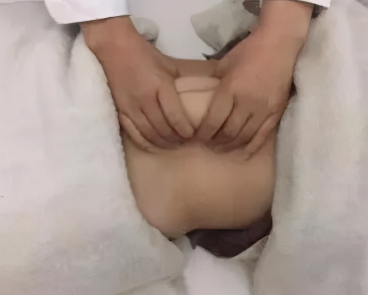 三指半到闭合，一个双胞胎妈妈的腹直肌康复之路