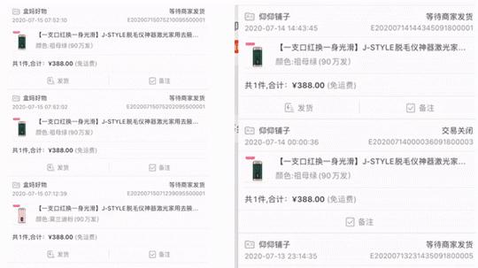 j-style脱毛仪怎么用,j-style脱毛仪怎样