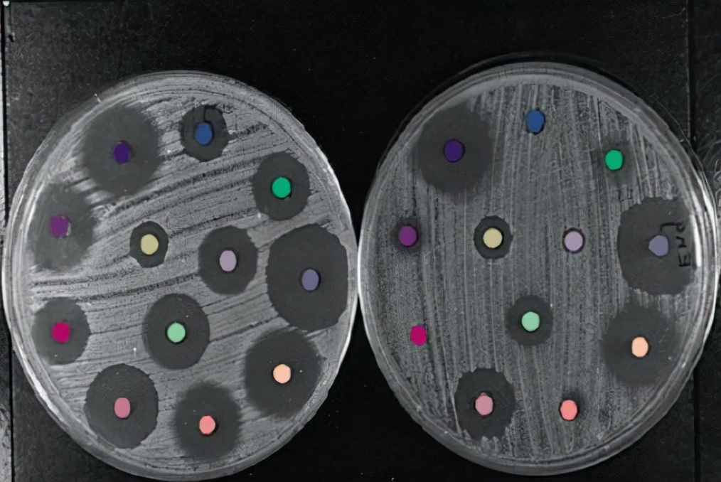 药敏是查什么的,药敏报告是怎么检查