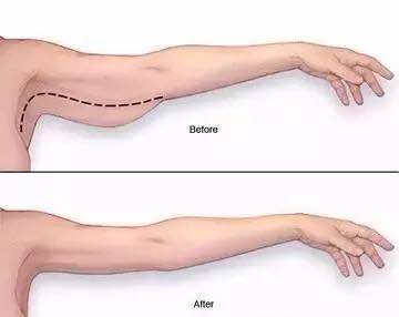 麒麟臂松松垮垮怎么练紧致,人到中年状态更松弛