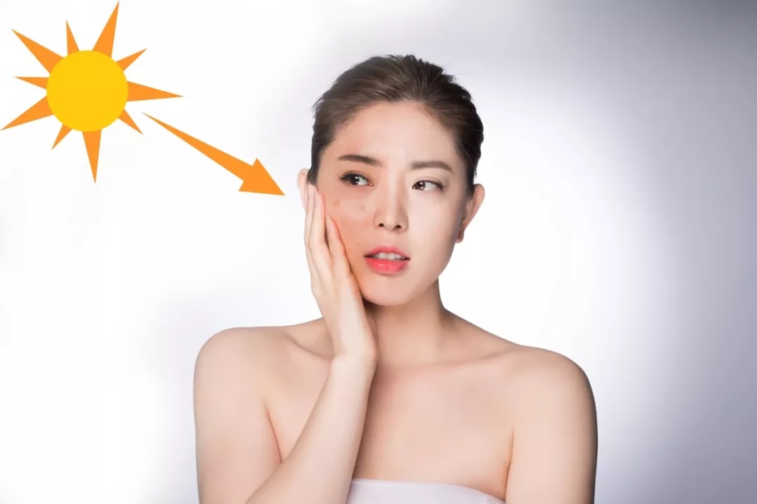 淡黄褐斑的办法,褐斑怎么消除最快方法