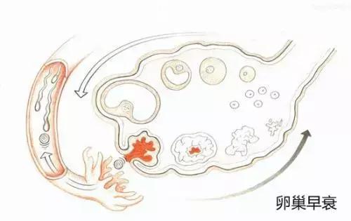 卵巢早衰来势汹汹？这5点是早衰“信号灯”，女性快自查