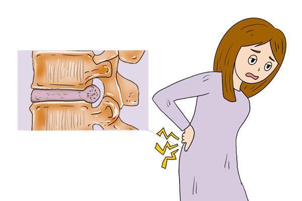 很容易闪到腰而且很疼是怎么回事,突然闪腰了怎么办