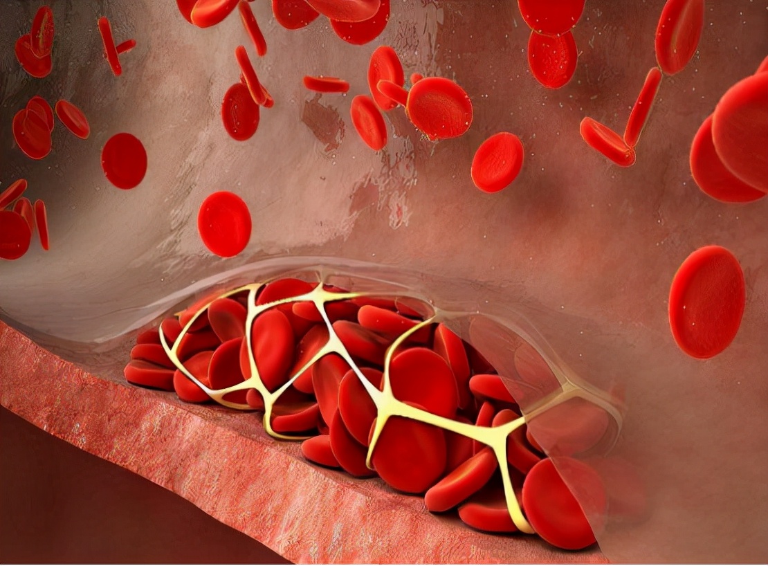 长期服用阿司匹林肠道出血怎么办,阿司匹林吃多怎么办