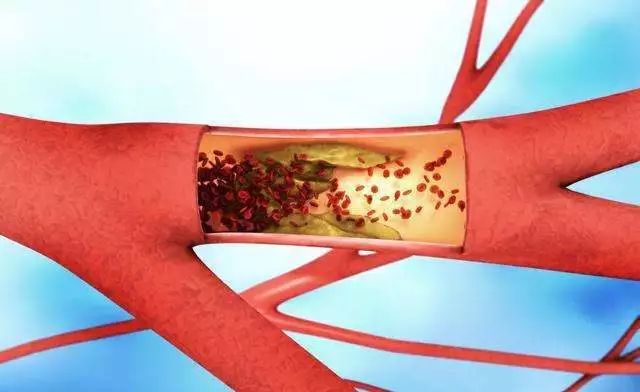 软骨肽和软骨素哪个好,鲟软骨活性肽