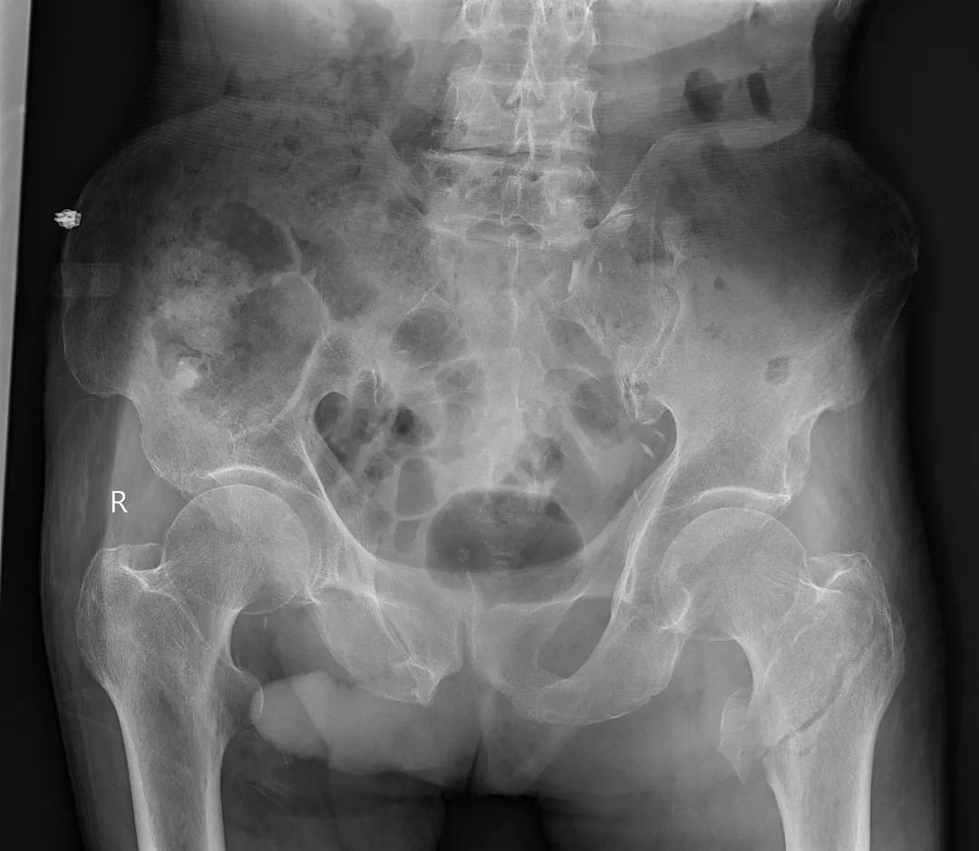 安健科技dr拍片质量怎么样,安健科技DR价格