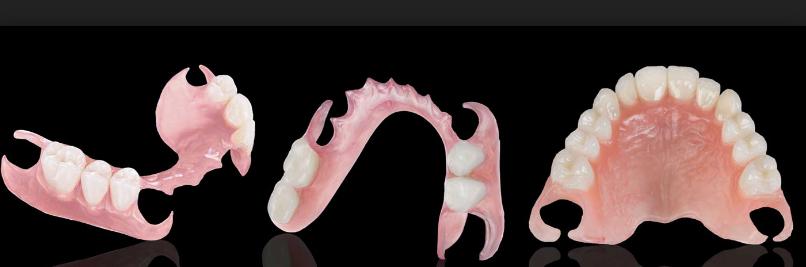 假牙制作纯手工,假牙新材料制作方法