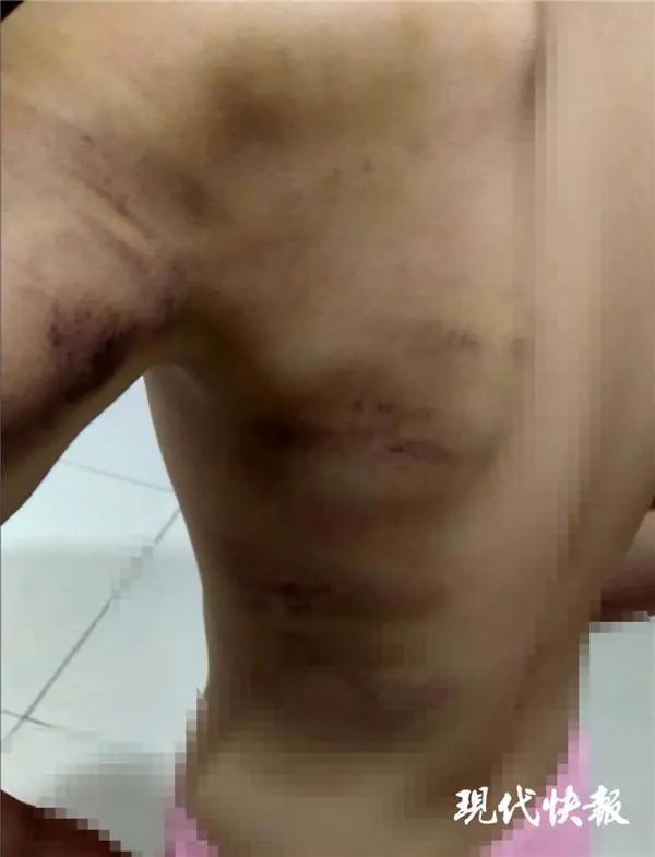 小学因作业被打,学生作业未完成被老师打了巴掌