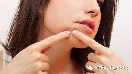 女生嘴巴周围长痘痘,嘴巴周围长痘痘还痒