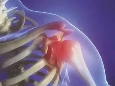 你的肩膀“冻住”了吗？