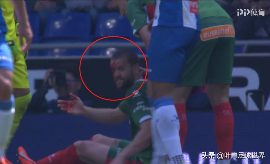 武磊被撞昏迷,武磊被自己队员撞到要点球