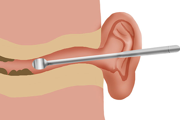 油耳朵有狐臭是哪里人,狐臭油耳朵和正常油耳朵的区别