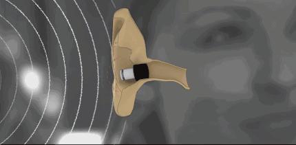 恐声症听到声音后怎么缓解,恐声症是什么原因造成的