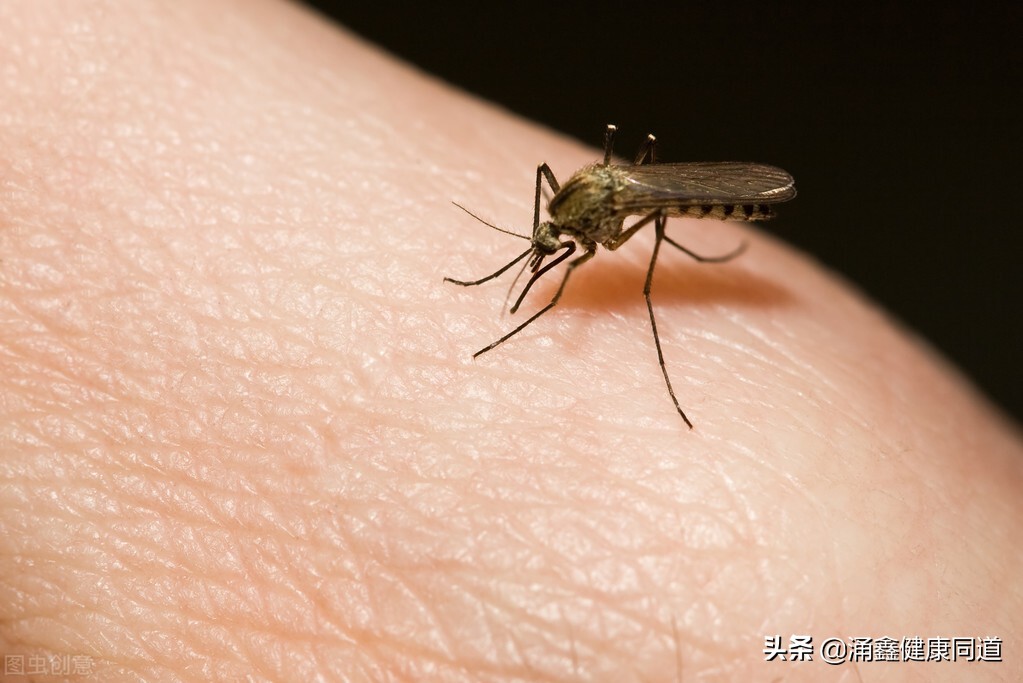 过敏起包像蚊子咬的如何止痒,孕妇被蚊子咬了怎么止痒消肿